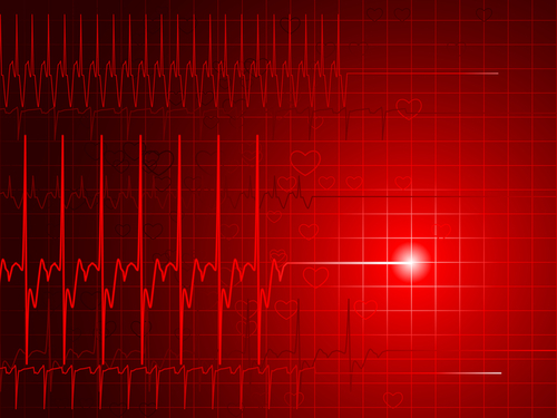 Study: Ransomware, Data Breaches at Hospitals tied to Uptick in Fatal Heart Attacks